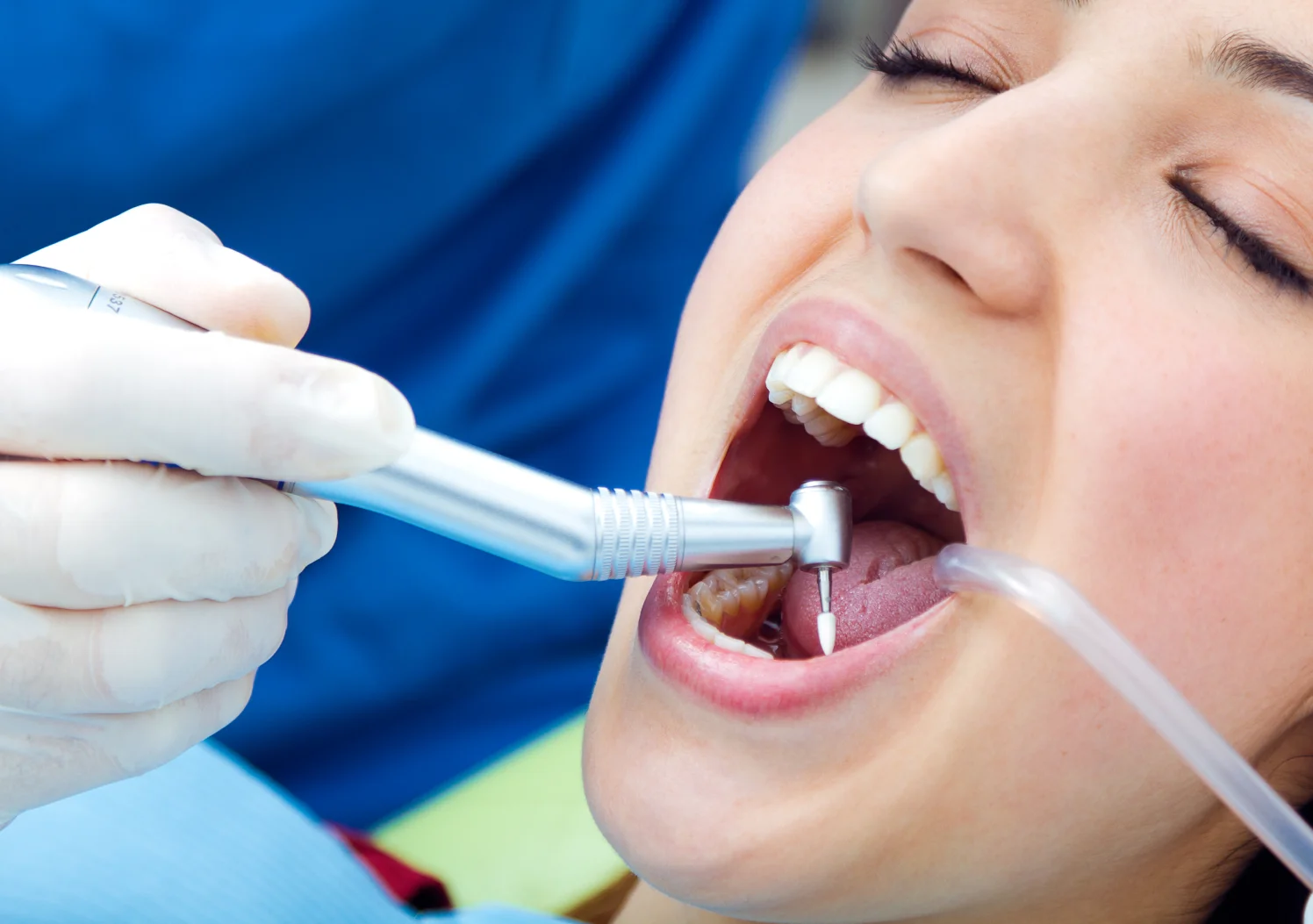 The Benefits of Getting Sedation Dentistry for Your Teeth, Chester Springs